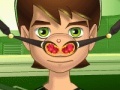 Gra Ben 10 Nose Doctor