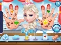 Gra Frozen Elsa Hand Doctor