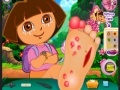 Gra Dora Foot Injuries