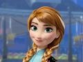 Gra Frozen Anna Dentist